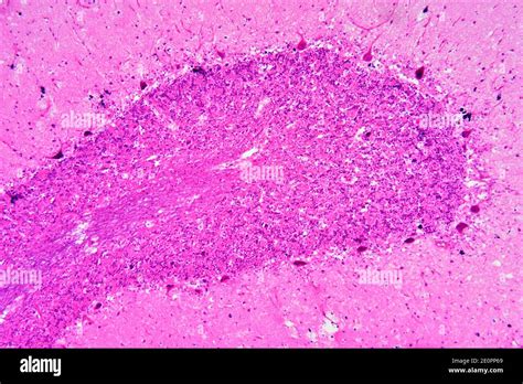 Purkinje Cells Histology