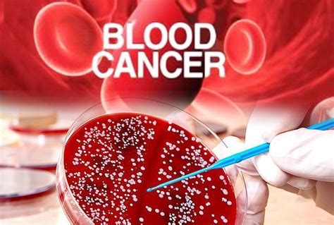 Blood Cancer Treatment - Blood Cancer Causes - The Fit Care