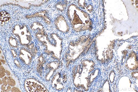 Anti Beta 2 Microglobulin Antibody B2m 01 Pe⚰️ Revolucione Seu Dia