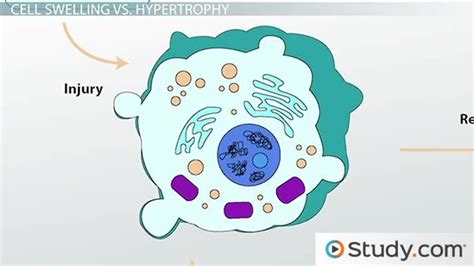 Hydropic Degeneration Causes And Significance What Causes A Cell To