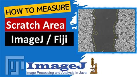 Scratch Assay Wound Healing Assay Cell Migration Assay Imagej Software Image Processing