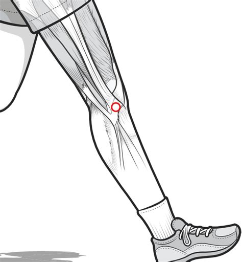 Gerdy's Tubercle Anatomy