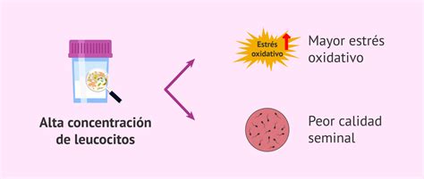 Qu Es La Leucospermia Piocitos En El Espermograma Y Tratamiento