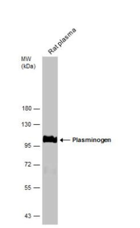 Plasminogen Antibody Novus Biologicals 0 1mL Unlabeled Fisher