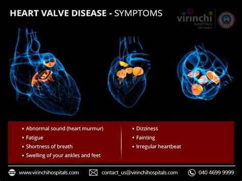 Heart Valve Disease Symptoms Heart Valve Disease Disease Symptoms