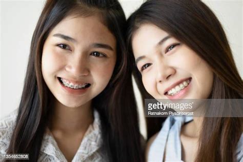 Portrait Of A Young Smiling Asian Woman With Braces On Teeth Orthodontic Treatment High Res