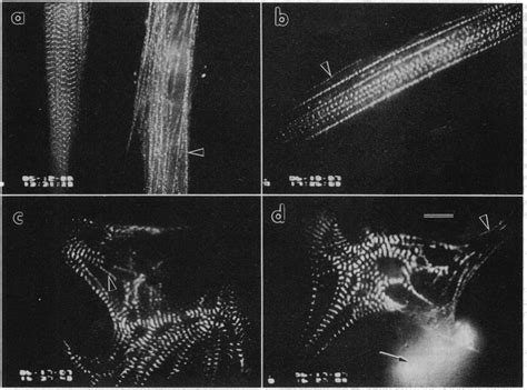 Phase Contrast A And Fluorescent B Micrographs Of A Ptk Cell