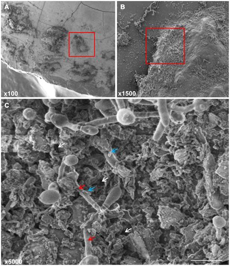 Scanning Electron Micrographs Of Mature Mixed Biofilms Of C Albicans