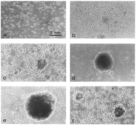 Immortalization Of Lymphocytes By L Cytoplast Fusion As Observed By