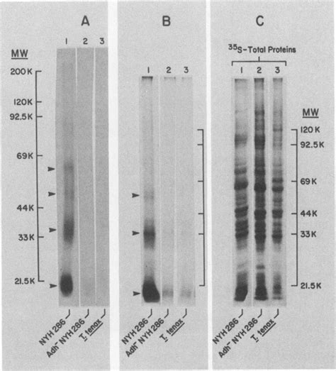 Sds Page Patterns Of Hela Cell Binding Proteins From I A And S