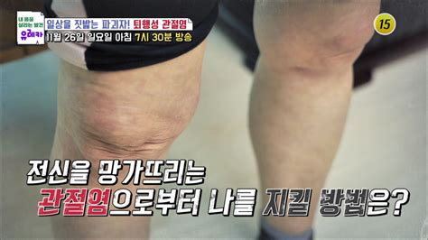 일상을 짓밟는 파괴자 퇴행성 관절염내 몸을 살리는 유레카 141회 예고 Tv Chosun 231126 방송 Zum Tv