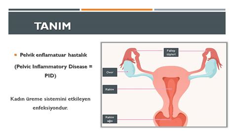 Pelvik Inflamatuar Hastal K Prof Dr Ba Ak Baksu