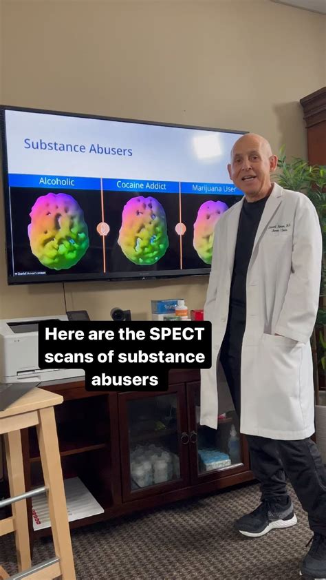 Watch This Reel By Doc Amen On Instagram Amen Brain Scan Daniel Amen