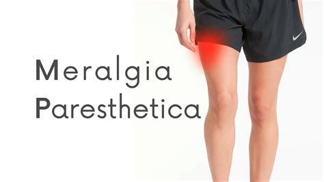 Meralgia Paresthetica Causes, Symptoms, Diagnosis, Treatment