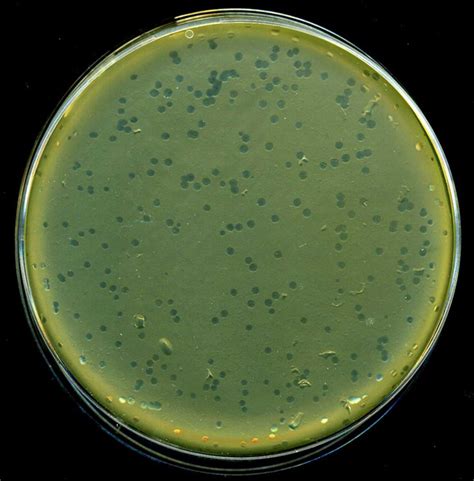 Phage Typing Of Bacteria Pharmaceutical Networking