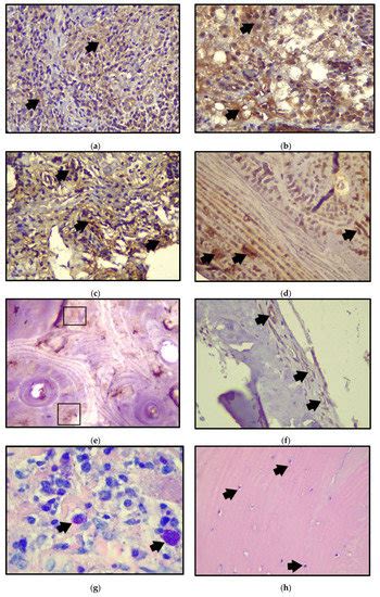 Ijerph Free Full Text Histological And Immunohistochemical Analysis Of Peri Implant Soft And