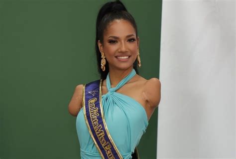 Victoria Salcedo, la candidata a Miss Ecuador que perdió sus brazos y pierna, pero no su amor a ...