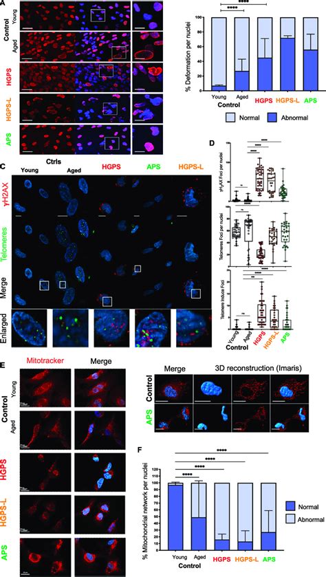 Hipsc Derived Mesenchymal Stem Cells Mscs From Patients With