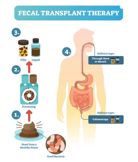 Fecal Transplantation: Science's Dirty Secret - Omixon