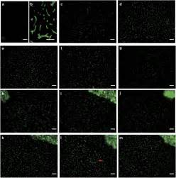 Immunofluorescence Of Aqp Protein Expression In Each Aqp Group