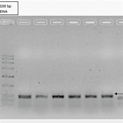 Agarose Gel Picture Showing Post Pcr Dna Bands Download Scientific