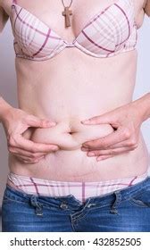 Abdominal Surface Fat Woman Stock Photo Shutterstock