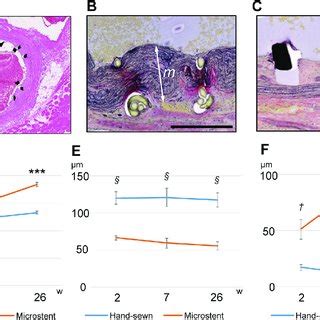 Histological examination of anastomosed vessels. (A) A cross-section of... | Download Scientific ...