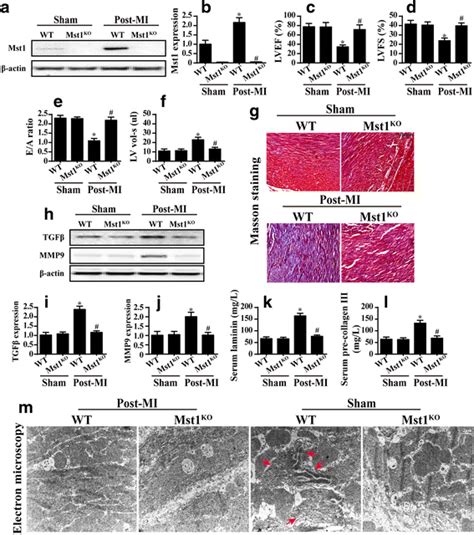 Mst1 Regulates Post Infarction Cardiac Injury Through The JNK Drp1