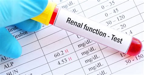 Insuficiência renal crônica tudo o que você precisa saber Médico