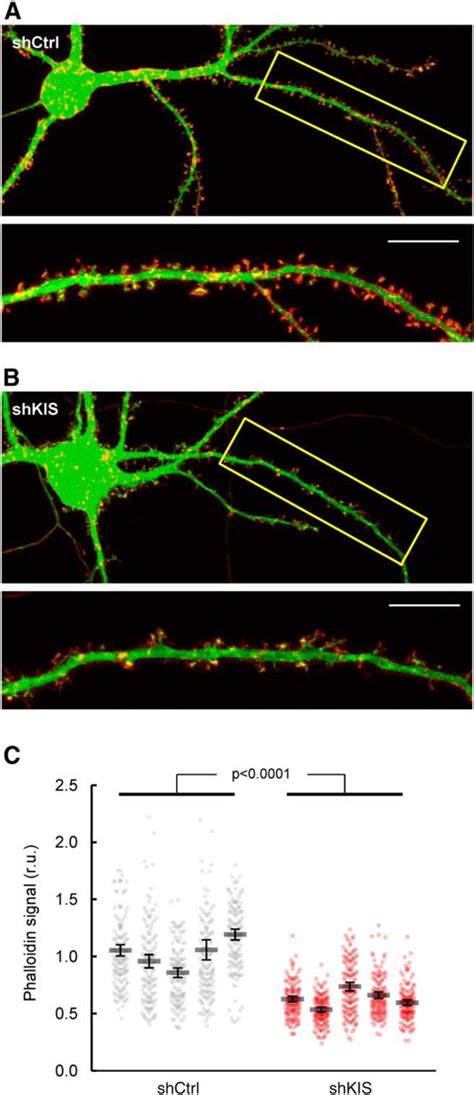 Kis A Kinase Associated With Microtubule Regulators Enhances