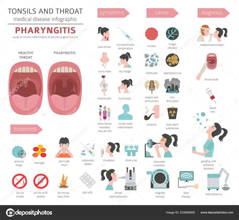 Tonsils Throat Diseases Pharyngitis Symptoms Treatment Icon Set Medical ...