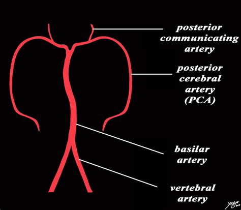 basilar artery  common vein
