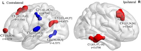 Frontiers Altered Spontaneous Brain Activity And Network Property In