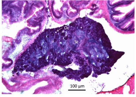 Male Ovotestis Representative Coronal Section Through The Gonad