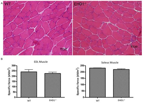 Eps Homology Domain Containing Ehd Skeletal Muscle Shows Normal