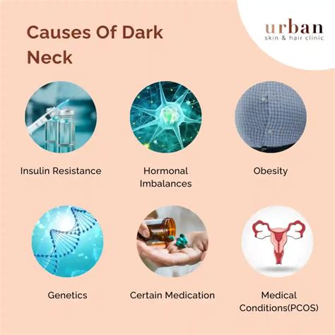 Dark Neck Causes, Symptoms & Treatment