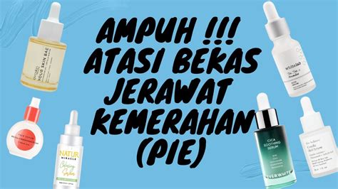 Serum Untuk Bekas Jerawat Kemerahan Pie Dengan Kandungan Centella