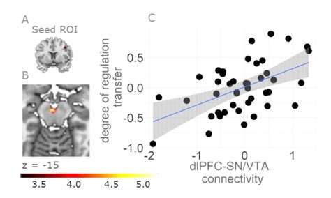 Functional Connectivity Between Dlpfc And Sn Vta Correlates With Download Scientific Diagram