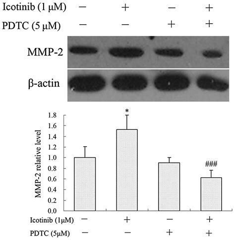 Icotinib Inhibits The Invasion Of Tca8113 Cells Via Downregulation Of