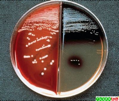 Microbiology Atlas Of Anaerobes Of Clinical Importance Free Medical