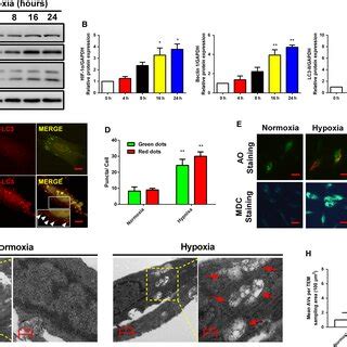 Hypoxia Induced Autophagy In Human Endometrial Stromal Cells Ab