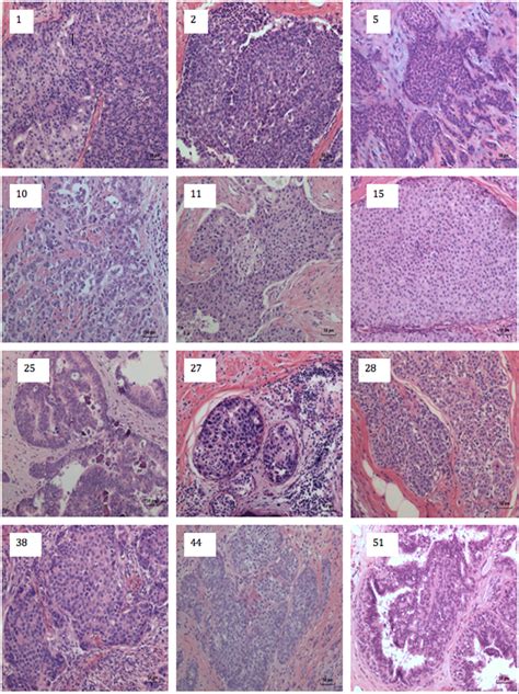 Frontiers Association Of Mouse Mammary Tumor Virus With Human Breast