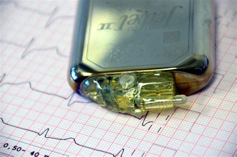 CDSCO issues alert on Medtronic's pacemakers, company says no product ...