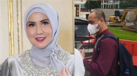 Kronologi Lengkap Aksi KDRT Ferry Irawan Hidung Venna Melinda Bersimba