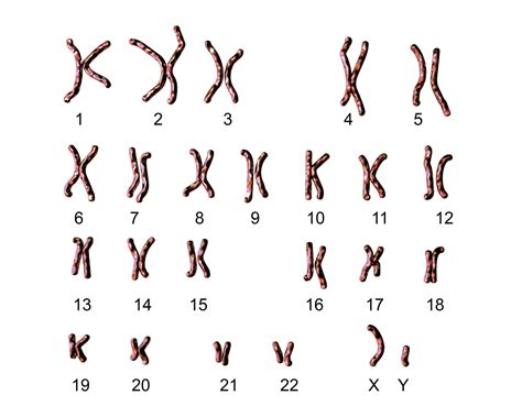 Caryotype Quest Ce Que Cest Fiches Santé Et Conseils Médicaux