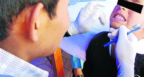 En Junín el 90 de los niños padecen de caries dental PERU CORREO