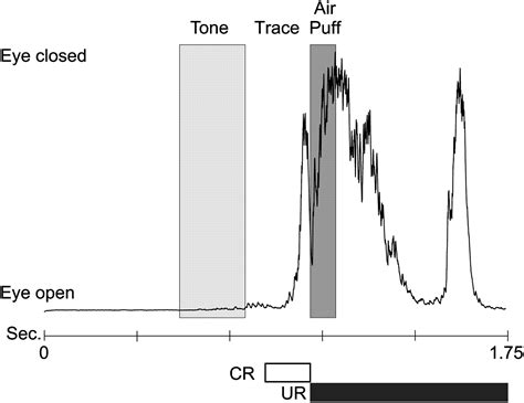 Blocking The Bk Channel Impedes Acquisition Of Trace Eyeblink Conditioning