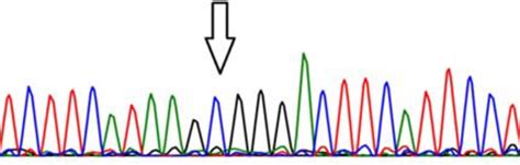 Figure 3 From The Impact Of Toll Like Receptor 2 Genetic Variations On Susceptibility To