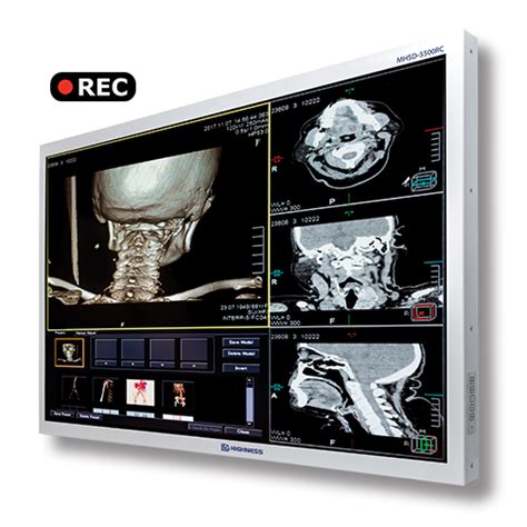 Surgical Monitors With Built In Recorder HighnessMicro