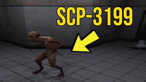 Scp 3199 Scp Observer 1 Youtube